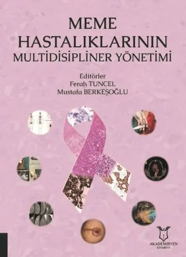 Meme Hastalıklarının Multidisipliner Yönetimi