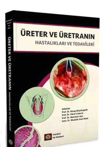Üreter Ve Üretranın Hastalıkları Ve Tedavileri