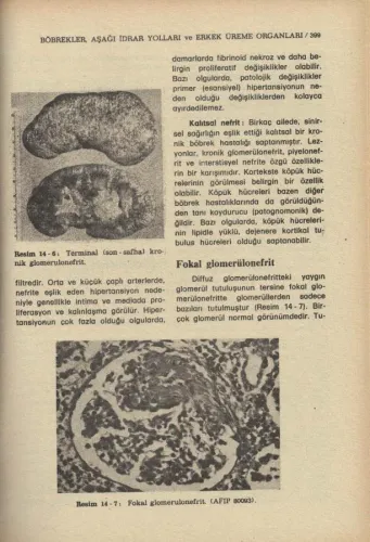 Kısa Patoloji W.A.D. Anderson Nobel %57 indirimli