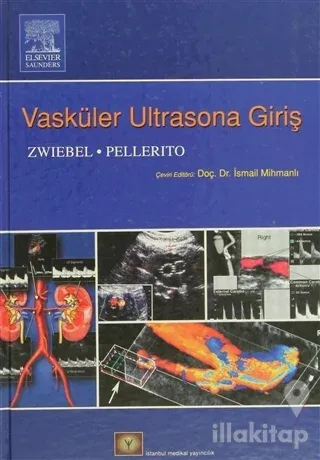 Vasküler Ultrasona Giriş (Ciltli)