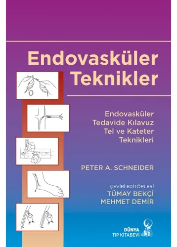 Endovasküler Teknikler