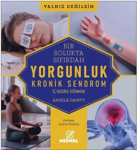 Yorgunluk