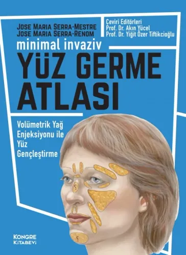 Yüz Germe Atlası