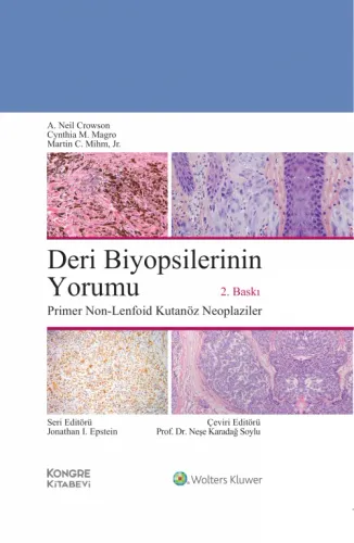 Deri Biyopsilerinin Yorumu