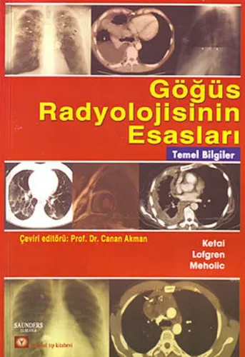 Göğüs Radyolojisinin Esasları