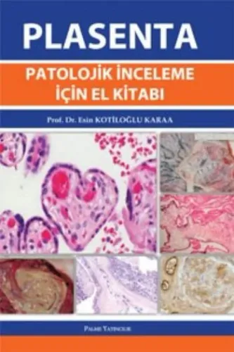 Plasenta Patolojik İnceleme için El Kitabı