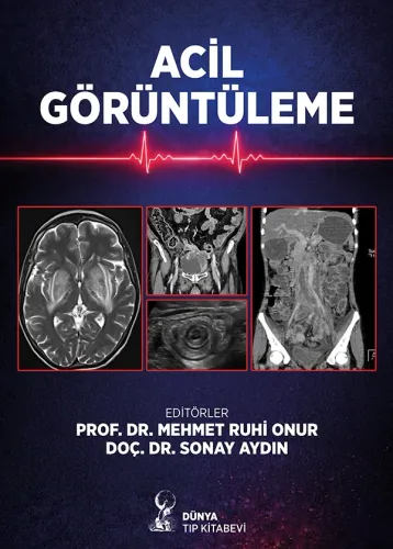 Acil Görüntüleme