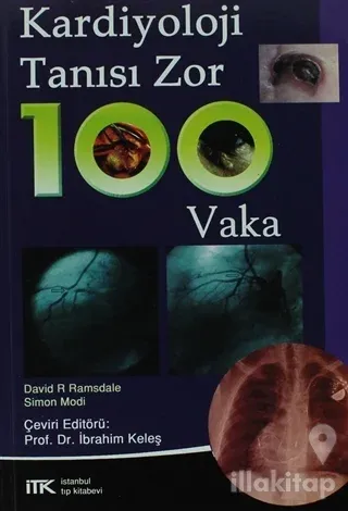 Kardiyoloji Tanısı Zor 100 Vaka