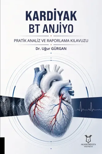 Kardiyak BT Anjiyo