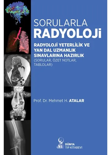 Sorularla Radyoloji