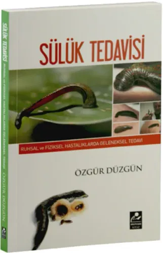 Ruhsal ve Fiziksel Hastalıklarda Geleneksel Tedavi - Sülük Tedavisi