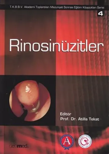 Rinosinüzitler
