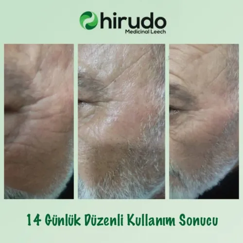 Skin Care Krem