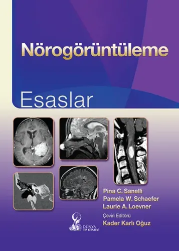 Nörogörüntüleme Esaslar