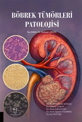 Böbrek Tümörleri Patolojisi
