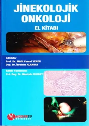 Jinekolojik Onkoloji El Kitabı