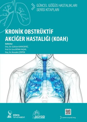 Kronik Obstrüktif Akciğer Hastalığı (KOAH): Güncel Göğüs Hastalıkları Serisi Kitapları
