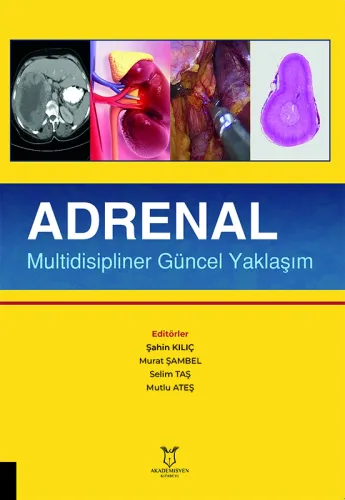 Adrenal Multidisipliner Güncel Yaklaşım