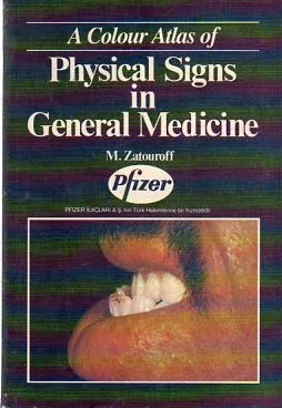 Physical Signs In General Medicine