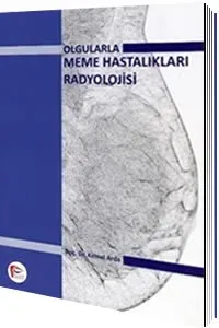 Olgularla Meme Hastalıkları Radyolojisi, Kemal Arda