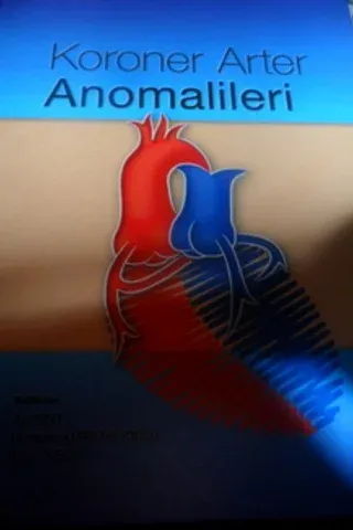 Koroner Arter Anomalileri