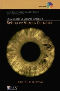 Retina ve Vitreus Cerrahisi