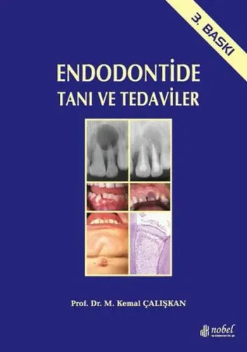 Endodontide Tanı ve Tedaviler