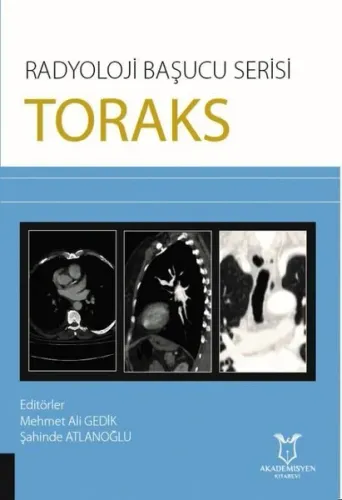 Toraks