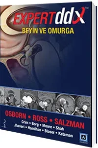 Expert DDX: Beyin ve Omurga